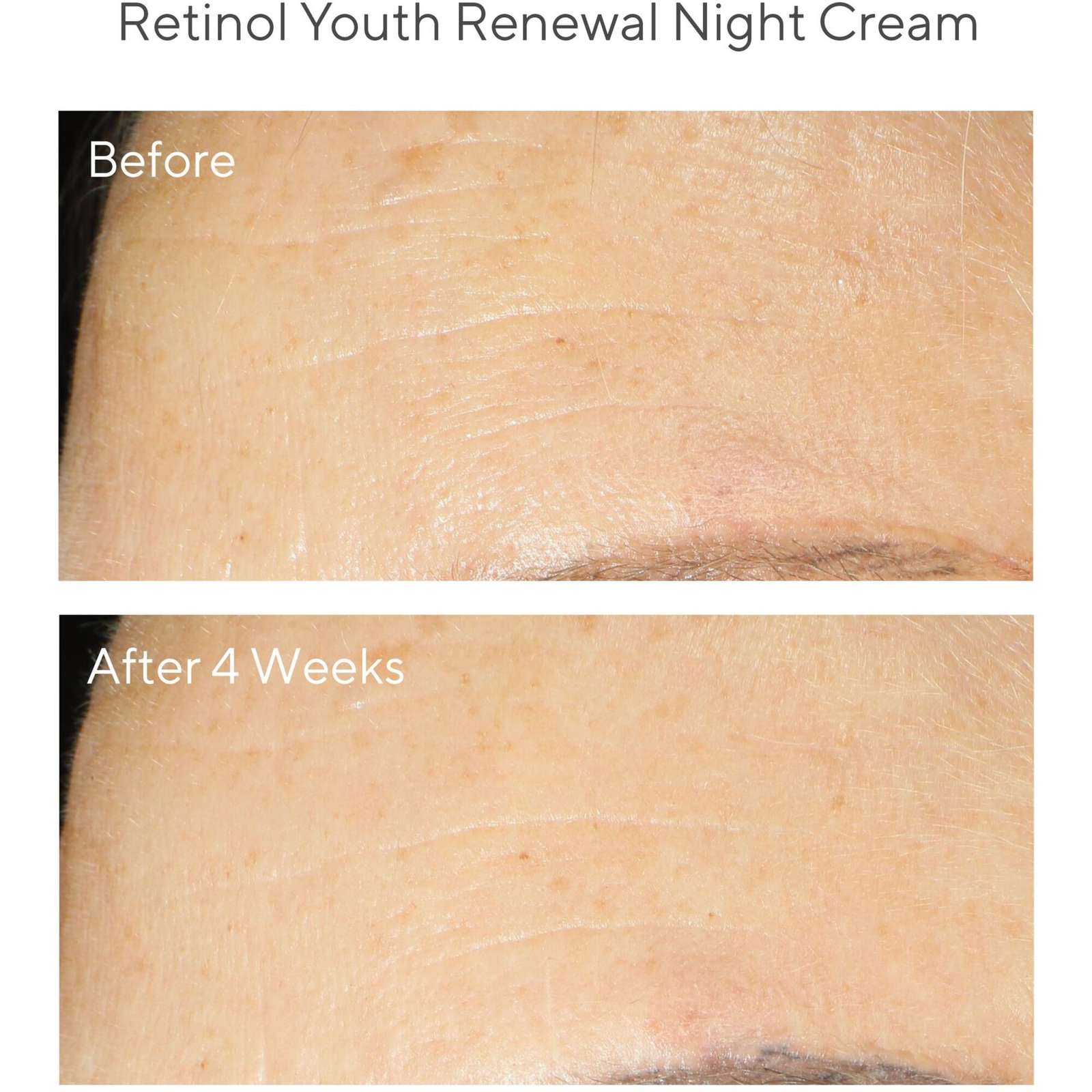 Retinol Youth Renewal Night Cream